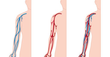 vein vs artery