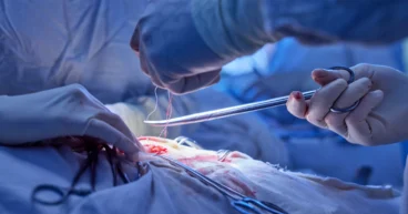 Vascular & Endovascular Surgery