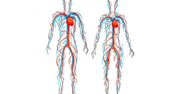 Vascular Trauma