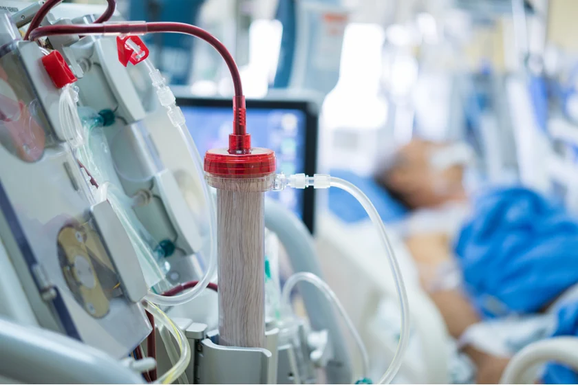 Understanding The Types Of Dialysis Catheter – Explain by Dr. Sumit Kapadia