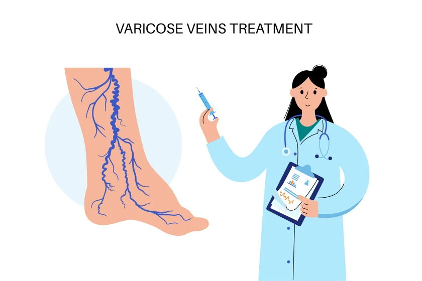 Which specialist doctor treats varicose veins?