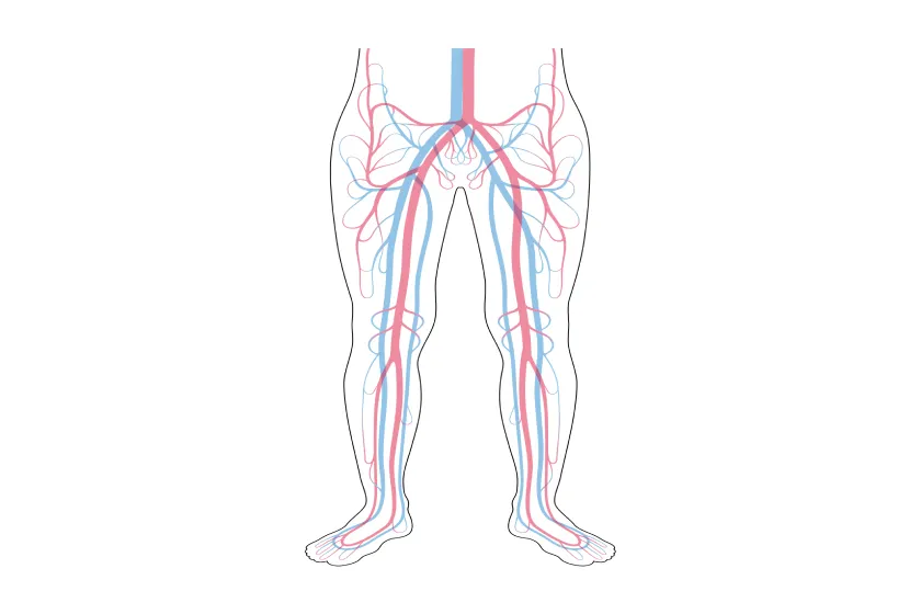 Stages of Vein Disease